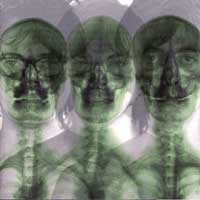 Supergrass